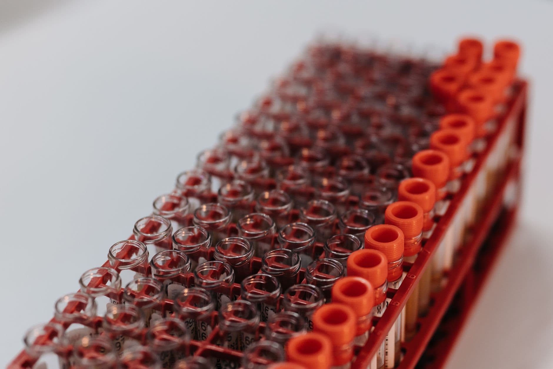 Is Prostate-Specific Antigen Screening Still Worth It?