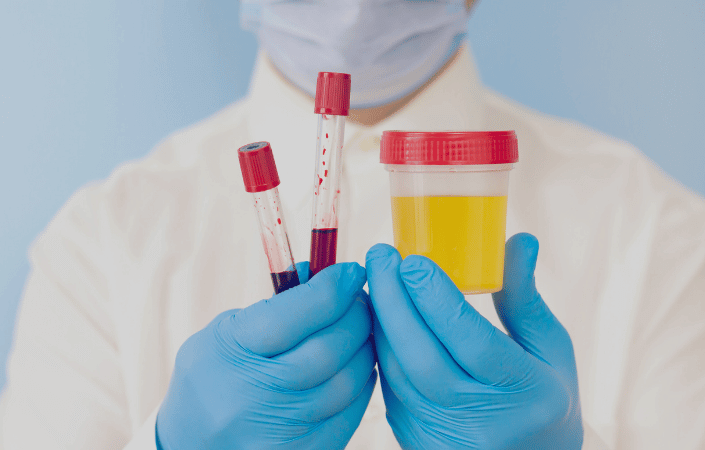 How to Test for Mercury Exposure