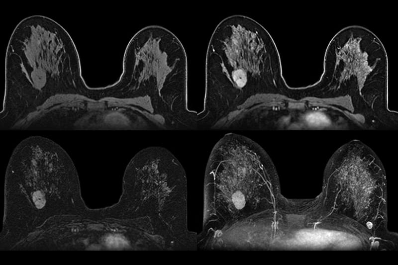 dexa process step