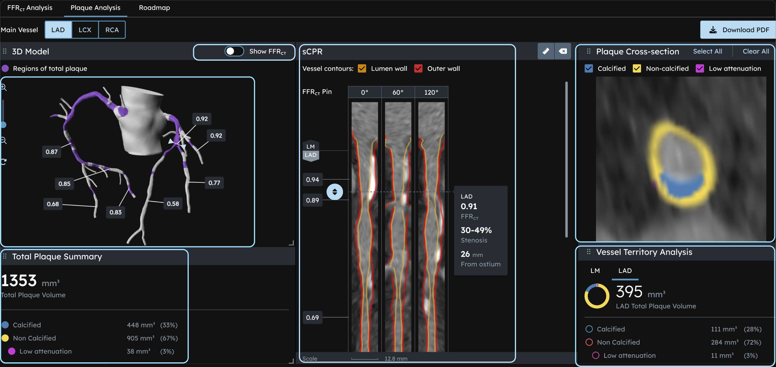 HeartFlow process step