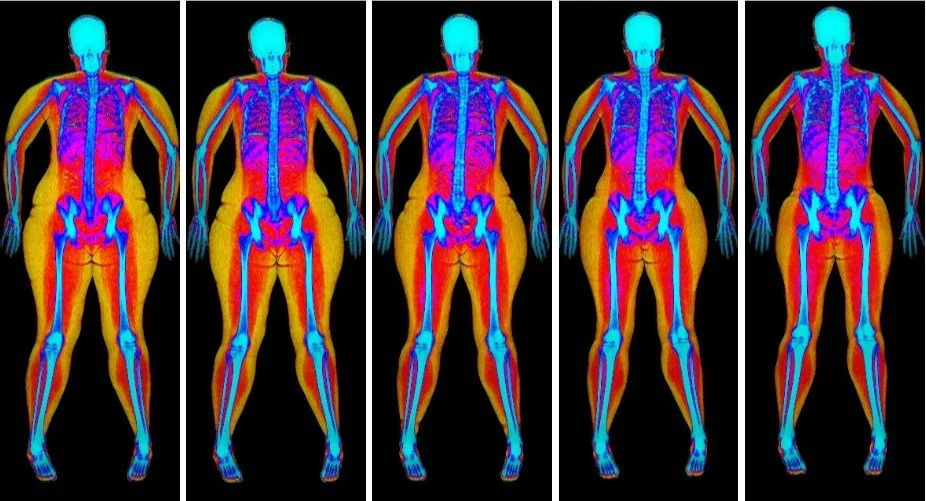 dexa process step